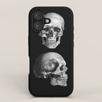 Skull Anatomy - Dark Version iPhone Case Gallery Image 1