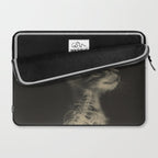 CAT scan Laptop Sleeve Gallery Image 2