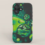 SLEEP APNEA iPhone Case Gallery Image 1