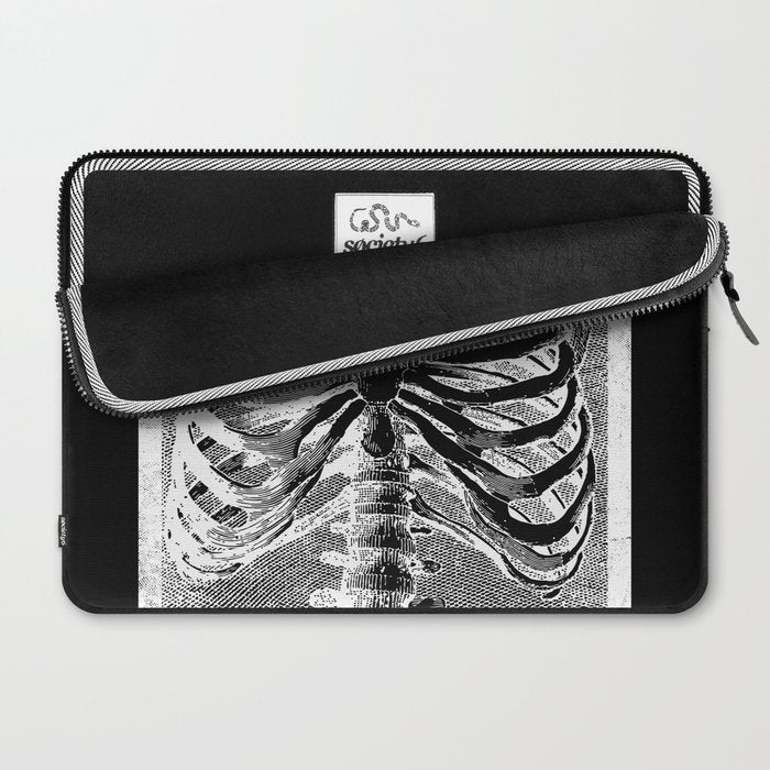 Vintage Skeleton Torso Laptop Sleeve Gallery Image 2