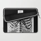 Vintage Skeleton Torso Laptop Sleeve Gallery Image 2