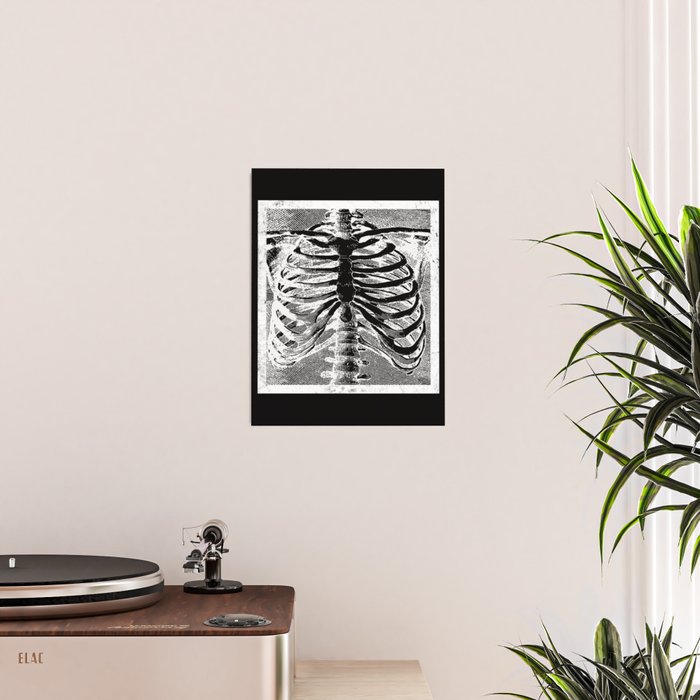 Vintage Skeleton Torso Poster Gallery Image 2