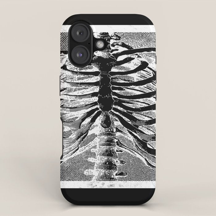 Vintage Skeleton Torso iPhone Case