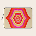 Sweet Kiss Laptop Sleeve Gallery Image 1