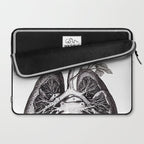 Flourishing Lungs Laptop Sleeve Gallery Image 2