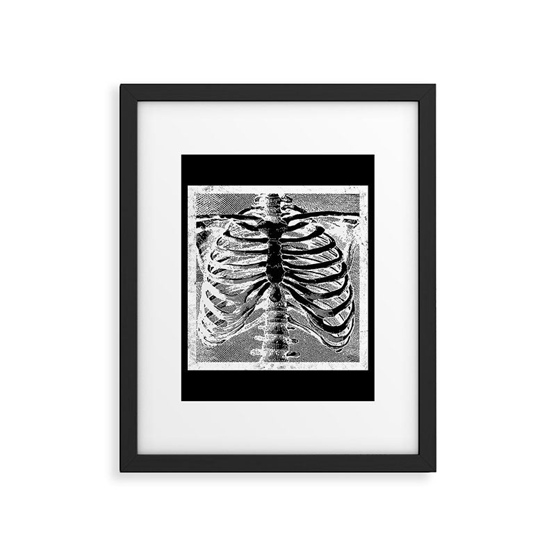Vintage Skeleton Torso Framed Art Print Gallery Image 6