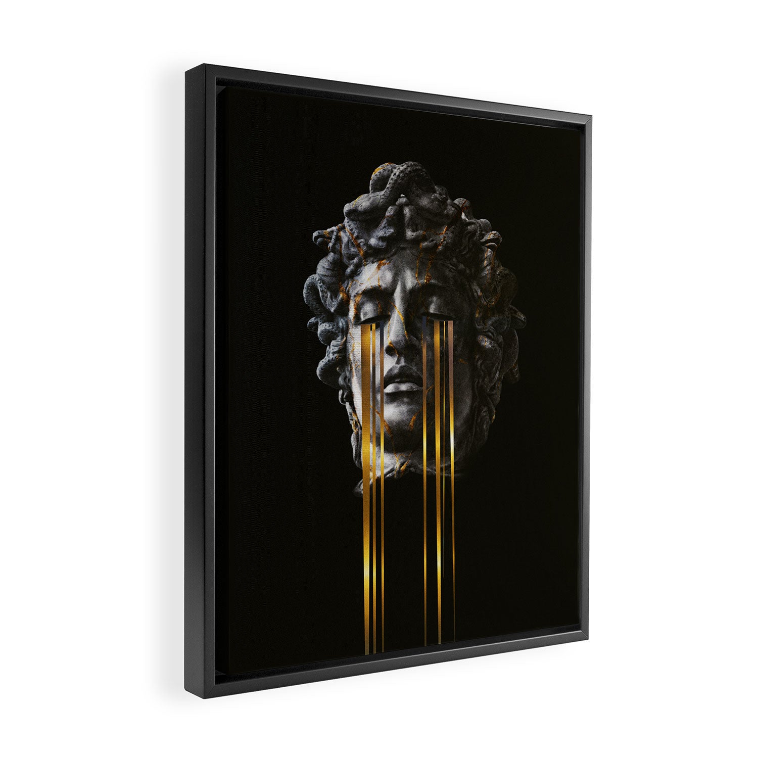MDS Framed Canvas Print Gallery Image 2