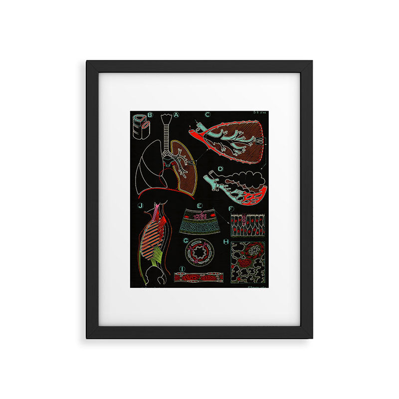 Paul Sougy: The Human Lung, 1957 (proceeds benefit The Nature Conservancy) Framed Art Print Gallery Image 5